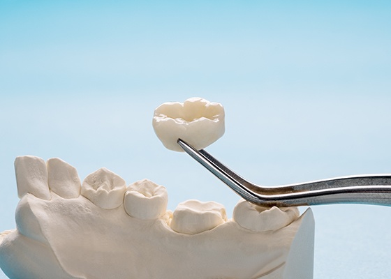 Tweezers holding a single dental crown next to a mock jaw