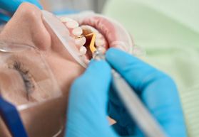 Dental patient preparing to receive scaling and root planing