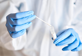 Lab technician swabbing saliva test